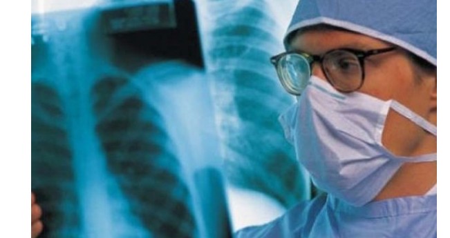 Kanceri i mushkërive, njihuni me simptomat..!?