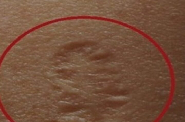 Shumë nga ju e kanë këtë shenjë në trup a e dini pse..?