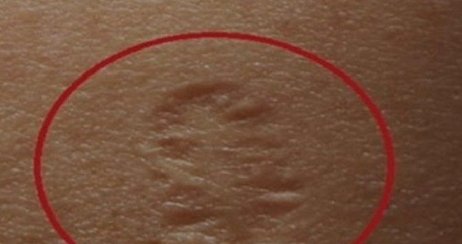 Shumë nga ju e kanë këtë shenjë në trup a e dini pse..?