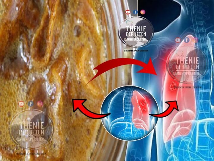Mjaltë dhe Limon Jeshil – Shurupi Natyral Kundër Kollës..