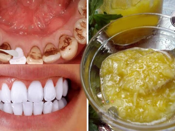 Ja çfarë duhet të konsumoni për dhëmbë të bardhë dhe të fortë..!?