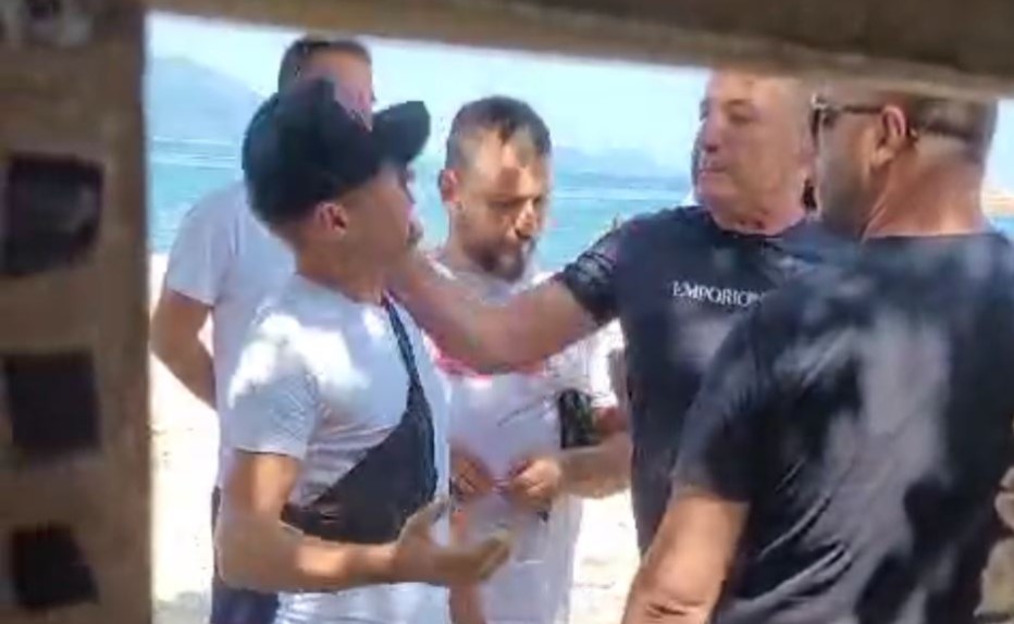 Shqipëri: Turisti ankohet për hapësirat e plazhit, han dajak nga pronari..! (VIDEO)