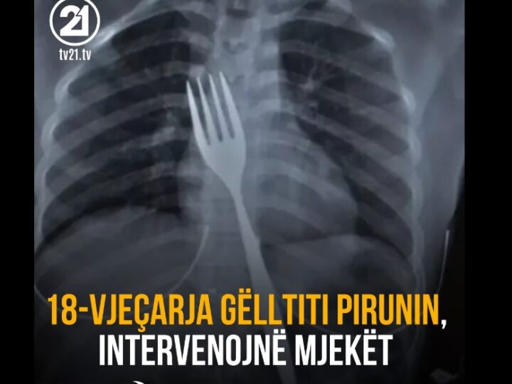 18-vjeçarja gëlltiti pirunin, intervenojnë mjekët !?