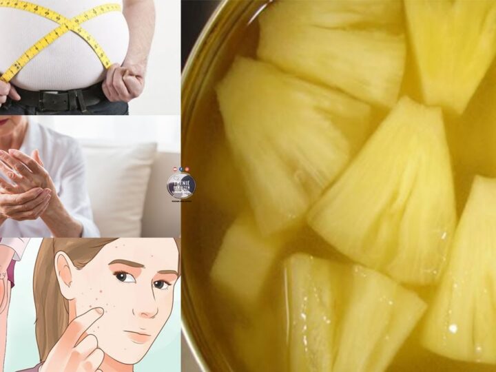 Ananasi, fruti mbretëror! Ja pse duhet shum ta konsumoni ?