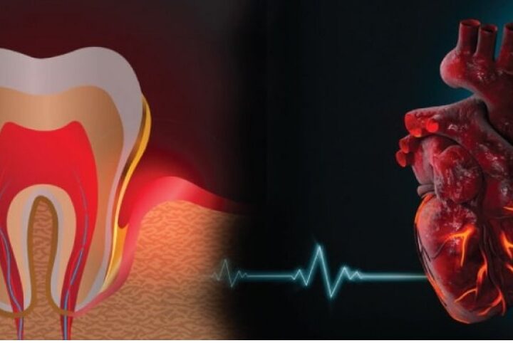 Dhëmbët e këqij shkaktojnë probleme me zemrën !?