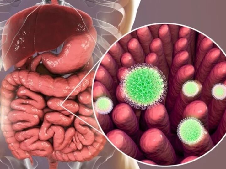 Zvicër: 35 ushtarë të infektuar me norovirus..!?