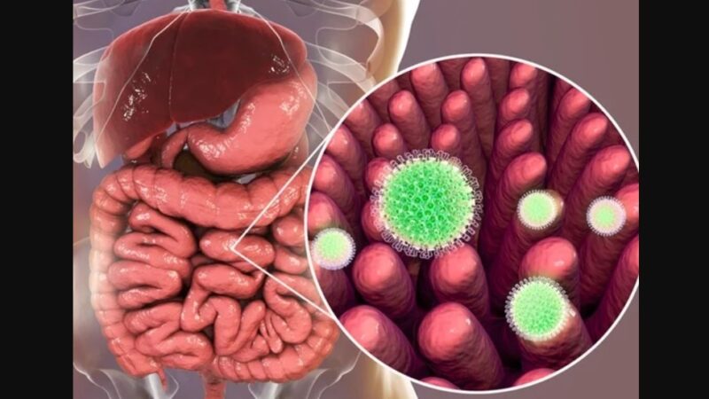 Mbi 150 persona në një anije turistike infektohen me virusin e rrallë !?