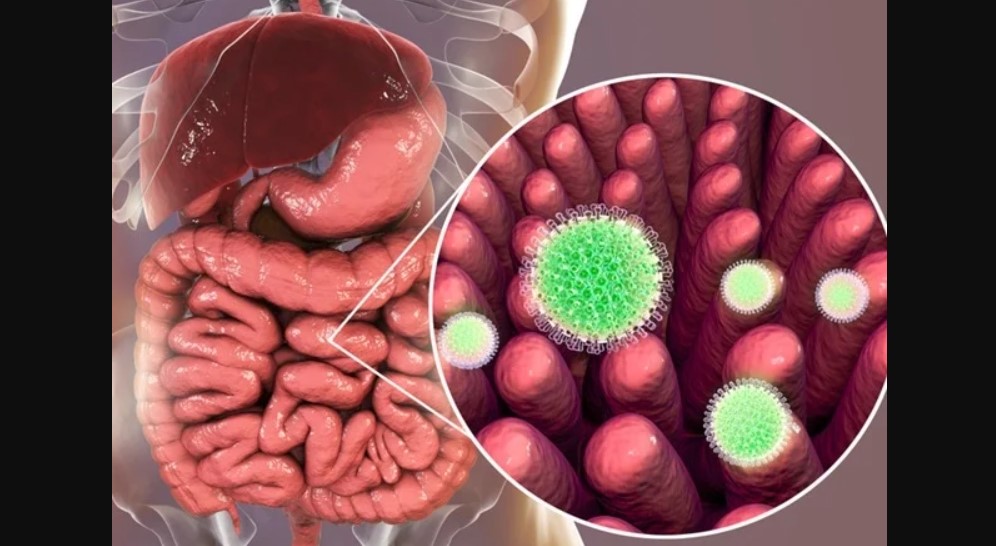 Zvicër: 35 ushtarë të infektuar me norovirus..!?