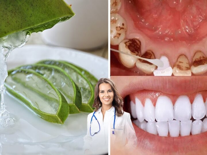 Si të përdorni aloe verën për shëndetin e dhëmbëve..!?