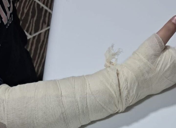SKANDAL: Mësusja e bën për spital 10-vjeçaren !