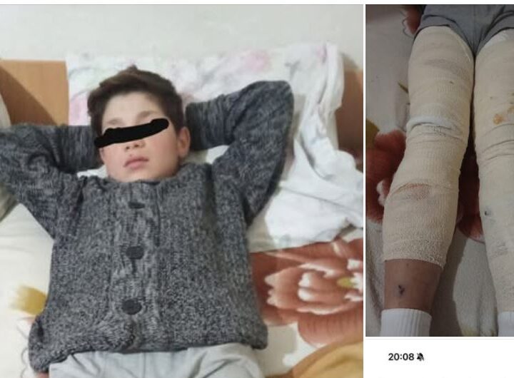 Kryetari Fatmir Dehari takon fëmijën që u sulmua nga qent endaca (FOTO)