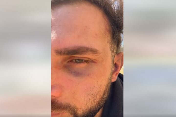 Shkoi të takoj një vajz në katund tjetër e rrahin brutalisht ! (VIDEO)