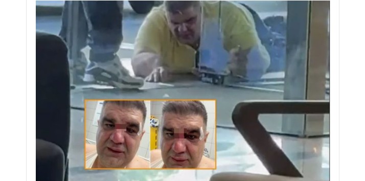 Biznesmeni i njohur serb rrihet keq në Zagreb të Kroacisë, dalin pamjet..!? (FOTO)