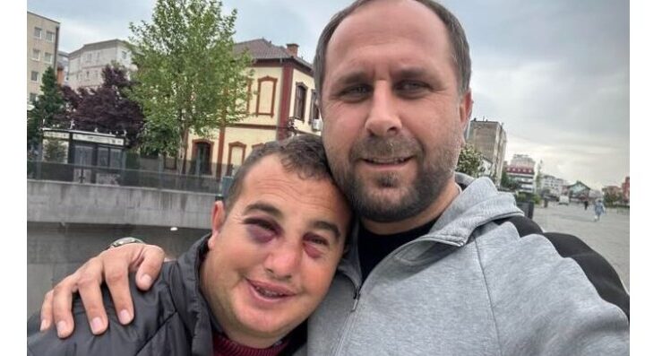 Rrihet jetimi me aftësi të kufizuara! Reagon kujdestari i tijë..!? (VIDEO)