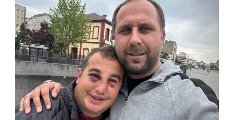 Rrihet jetimi me aftësi të kufizuara! Reagon kujdestari i tijë..!? (VIDEO)