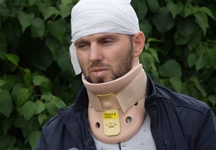 Refen i dëmtuari! Fajdexhinjtë më bënë për spital, në prani të vajzës së mitur..!? (VIDEO)