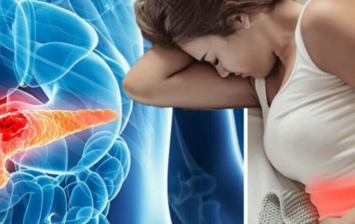 Simptomat që lidhen me kancerin e pankreasit..!?