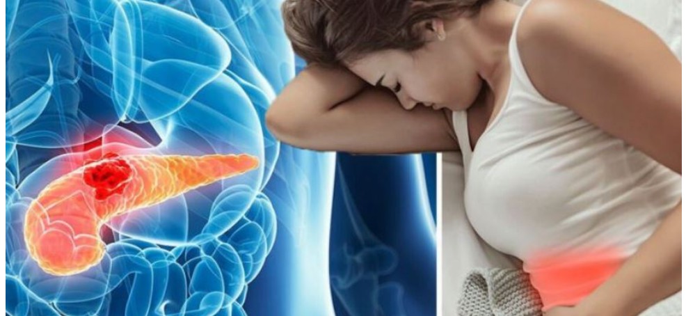 Simptomat që lidhen me kancerin e pankreasit..!?