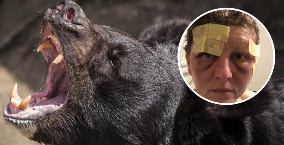 Maqedoni: Një grua është sulmuar nga ariu..!?