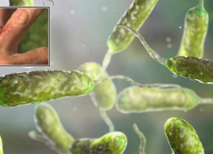 Shkencëtarët zbulojnë “superbakterin” 5,000-vjeçar rezistent ndaj antibiotikëve ?