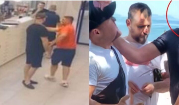 Bëhet për spital polici që dhunoi kamarierin..!?