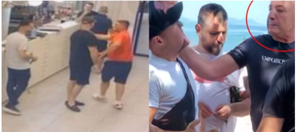 Bëhet për spital polici që dhunoi kamarierin..!?