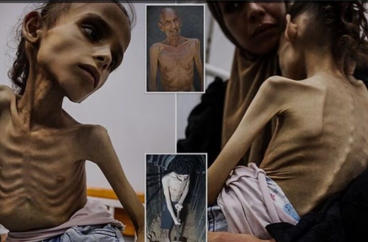 Si e ktheu Izraeli Gazën në një kamp vdekjeje !