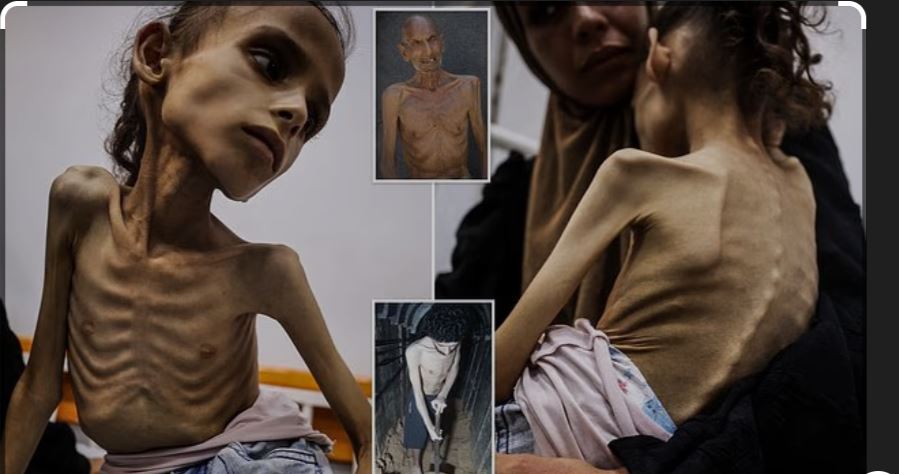 Si e ktheu Izraeli Gazën në një kamp vdekjeje !