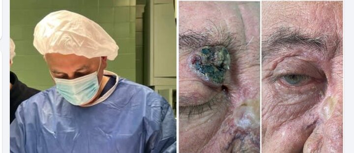 Tv Gurra: Kirurgjia plastike në Kërçovë po ecën përpara fal Dr Senaver Selimit