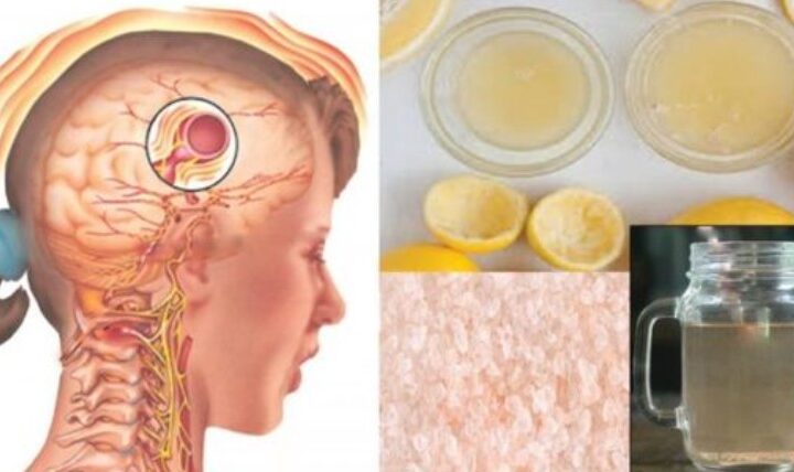 Kjo recetë mund të ndalojë dhimbjen e kokës dhe migrenën për disa minuta ?