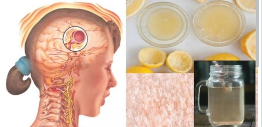 Kjo recetë mund të ndalojë dhimbjen e kokës dhe migrenën për disa minuta ?