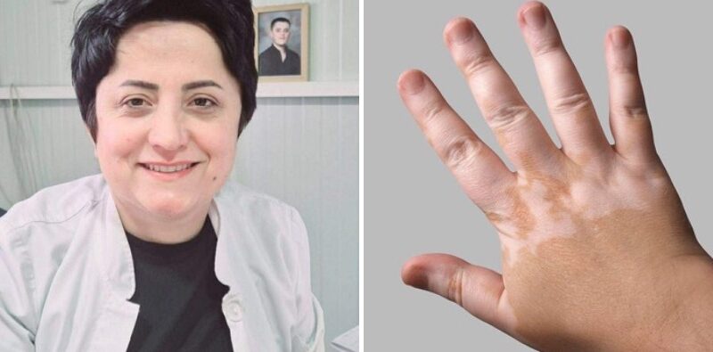 Zbulohet terapia për sëmundjen që konsiderohej e pashërueshme, do e prezanton Dr. Lulije Jahja nga Kërçova