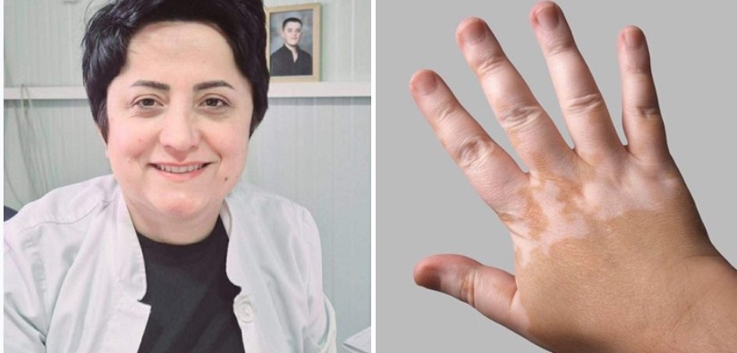 Zbulohet terapia për sëmundjen që konsiderohej e pashërueshme, do e prezanton Dr. Lulije Jahja nga Kërçova