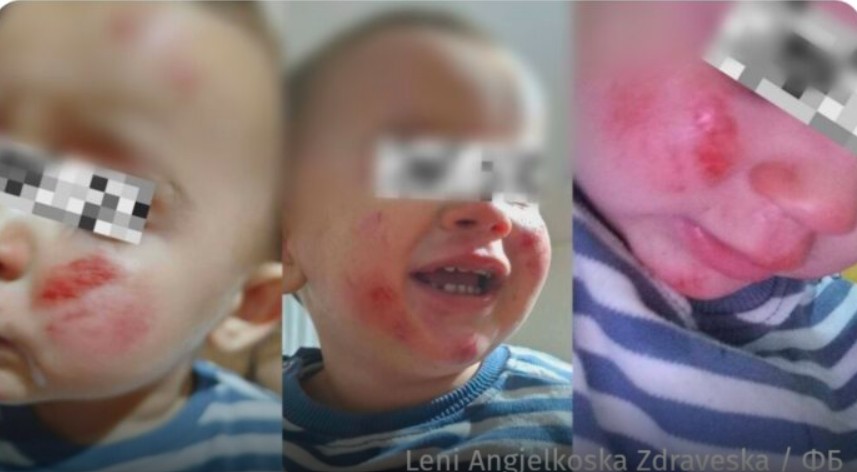 Kërçovë: Nëna e tmerruar ! Ma morën fëmijën nga krahët